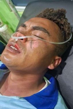 Relawan Terluka di Dapur MBG Solok, Penguatan Keselamatan Kerja SPPG Dinilai Mendesak